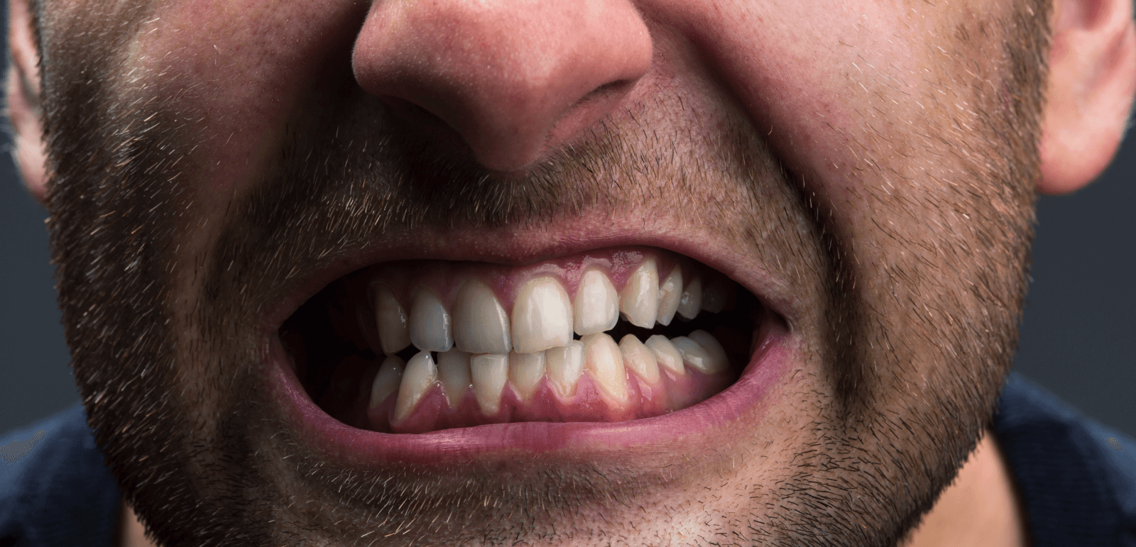 焦虑和牙齿问题